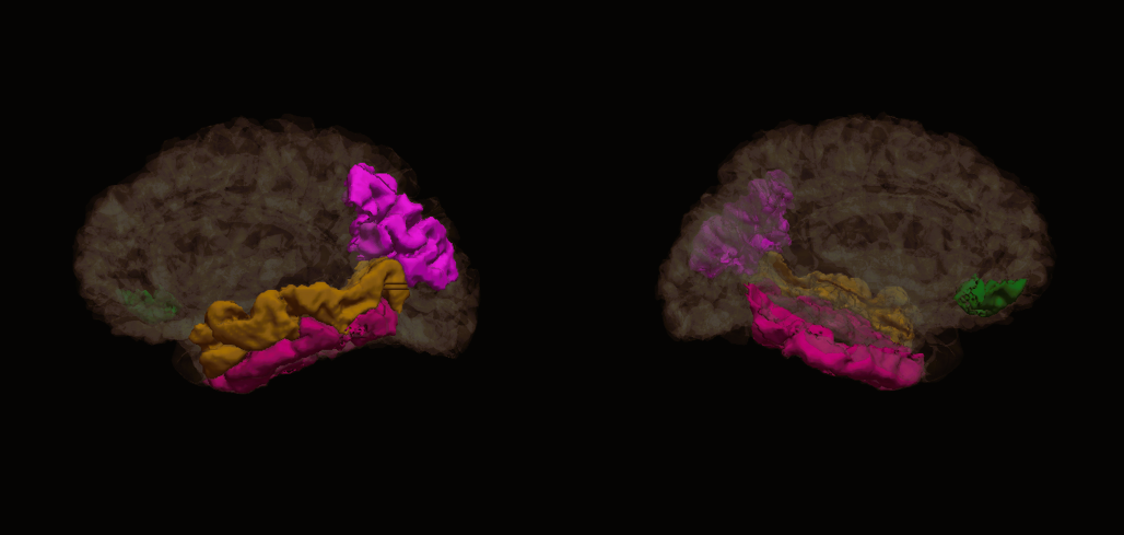 brain_regions - Copy (2).png